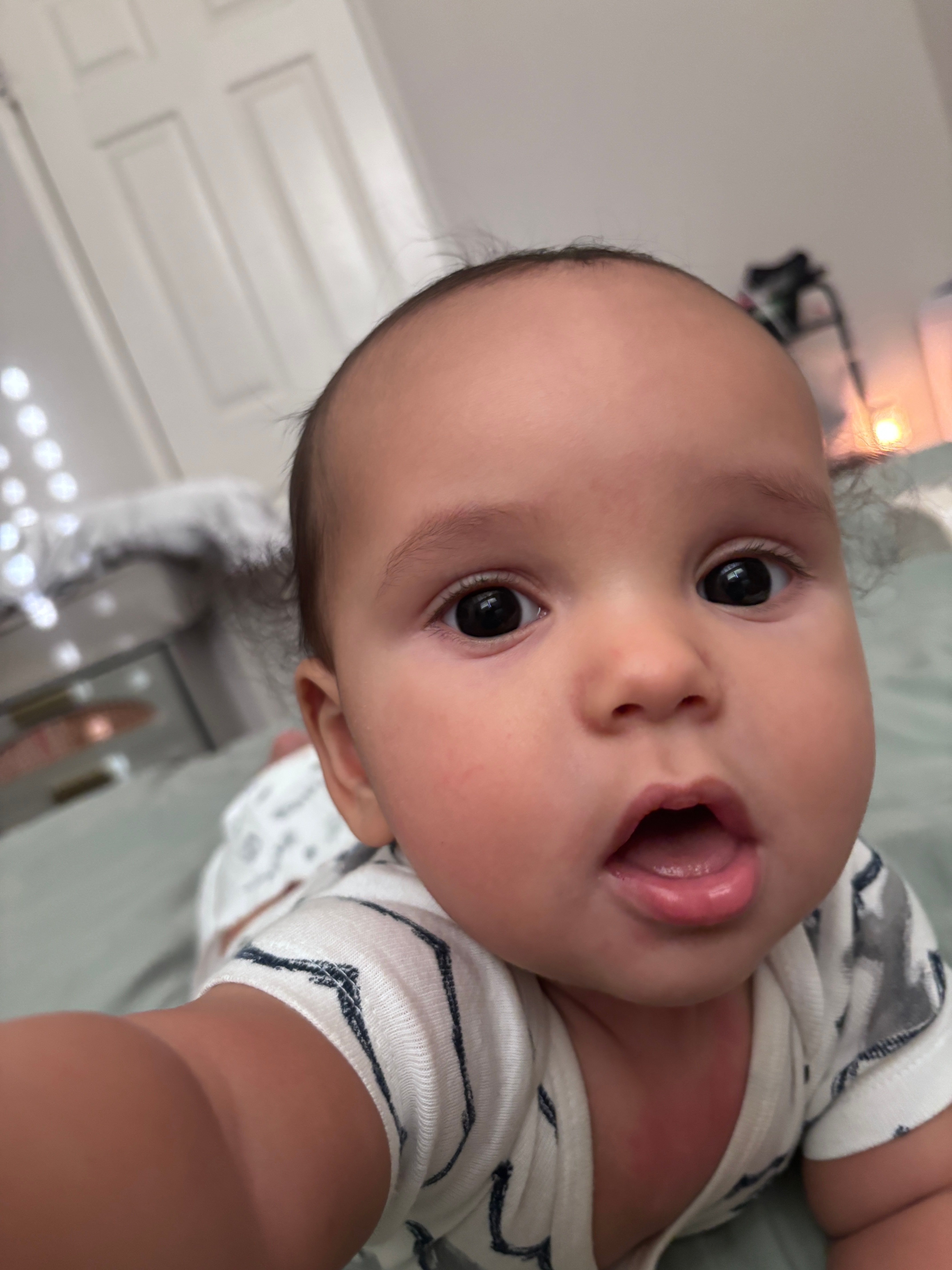 Noah looking up at the camera in a striped onesie